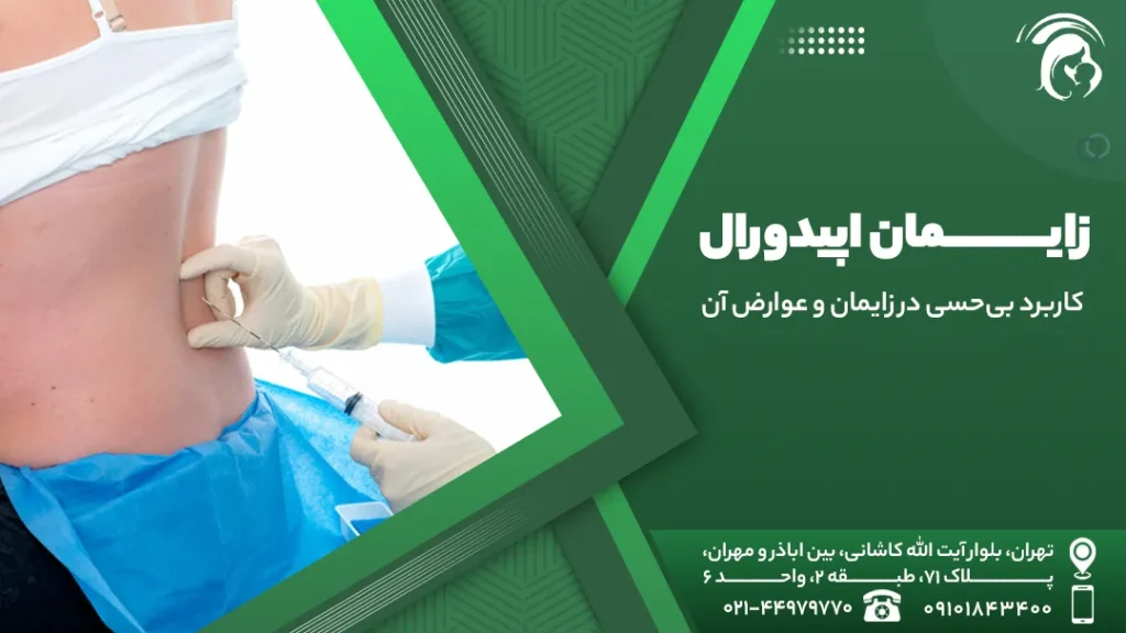 زایمان اپیدورال