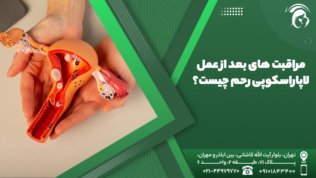مراقبت های بعد از عمل لاپاراسکوپی رحم