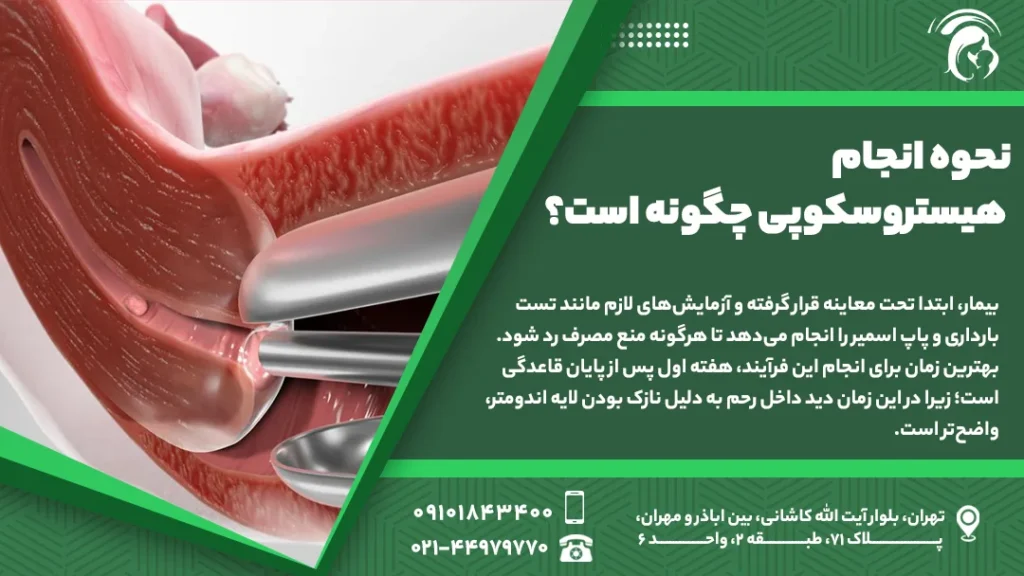 درباره نحوه انجام هیستروسکوپی چگونه است؟
