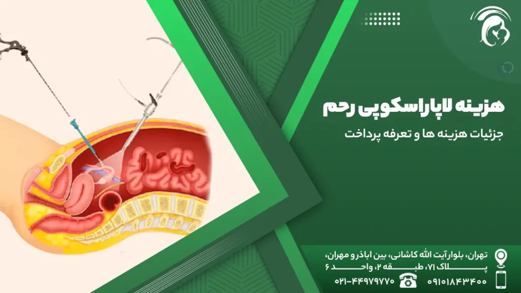 هزینه لاپاراسکوپی رحم