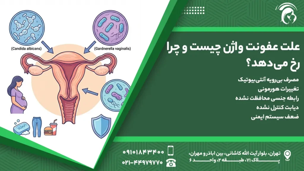 علت عفونت واژن چیست؟