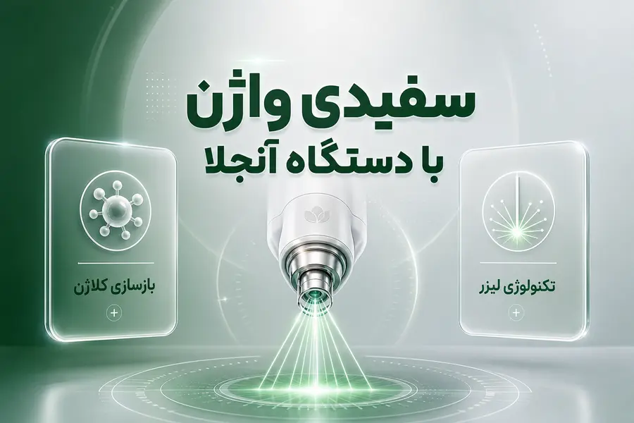 سفیدی واژن با دستگاه آنجلا