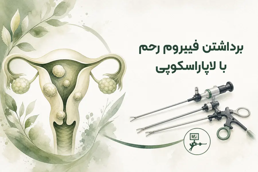 برداشتن فیبروم رحم با لاپاراسکوپی
