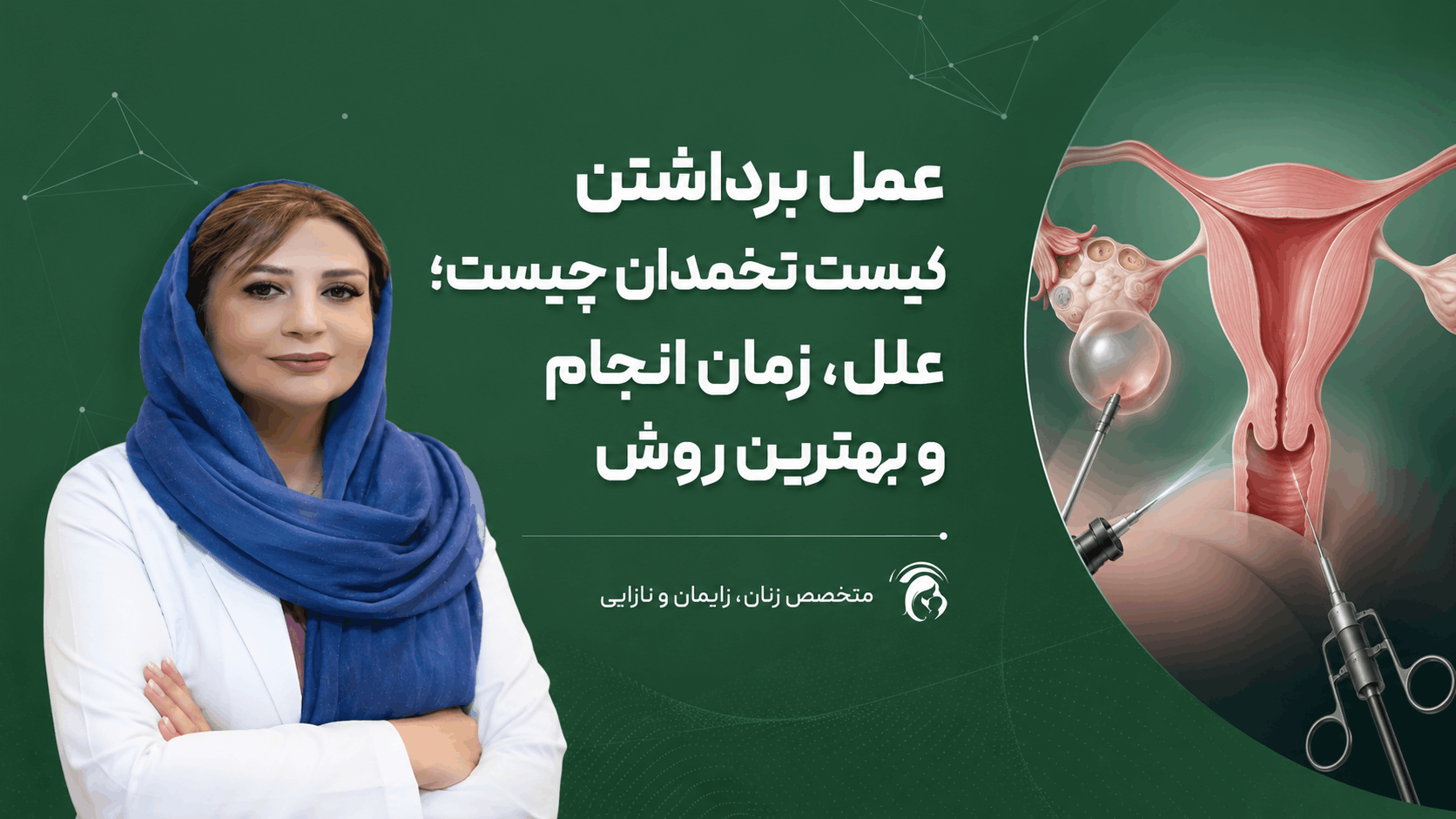 عمل برداشتن کیست تخمدان
