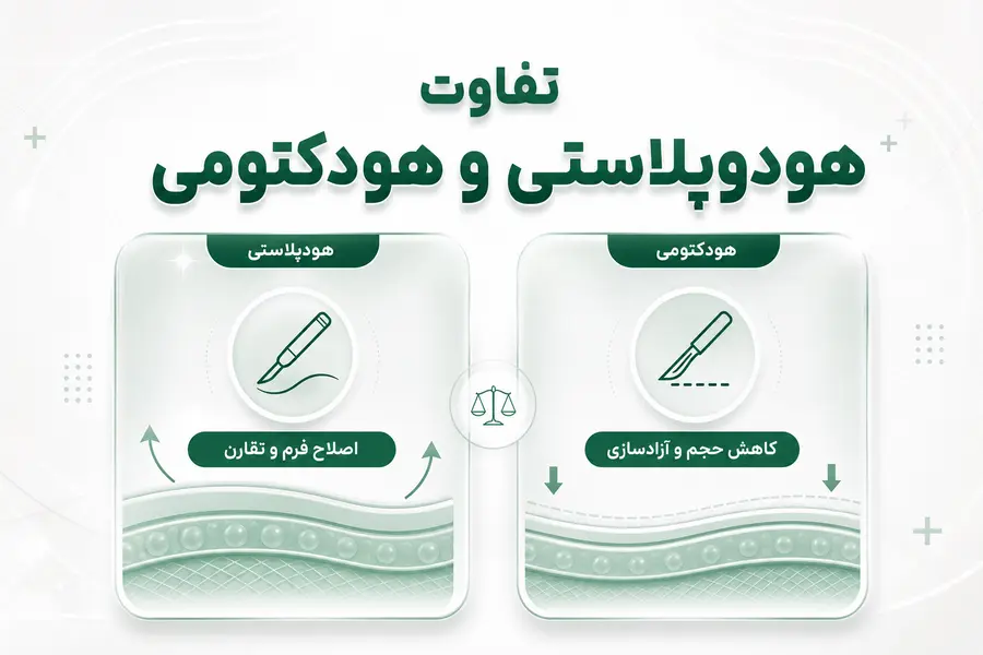 تفاوت هودوپلاستی و هودکتومی
