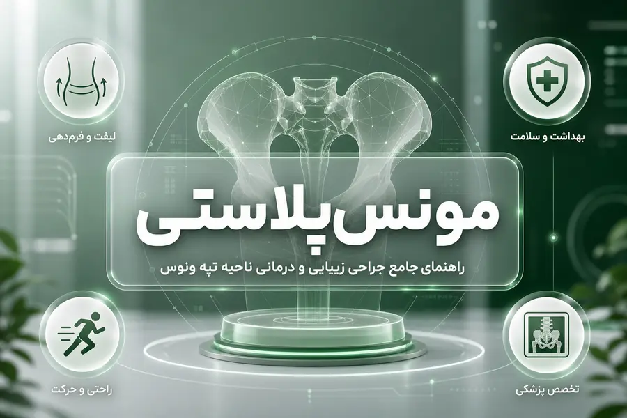 مونس‌ پلاستی