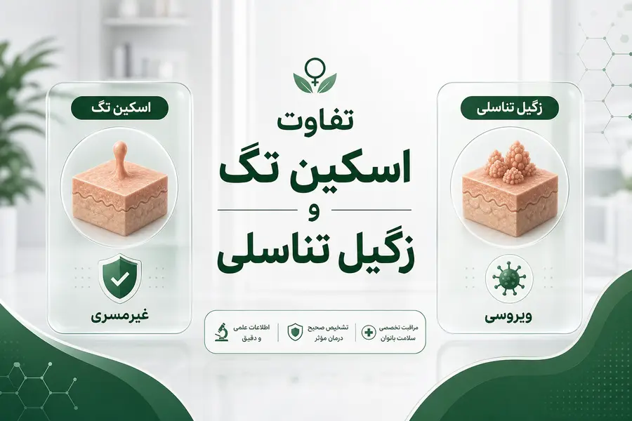 تفاوت اسکین تگ و زگیل تناسلی