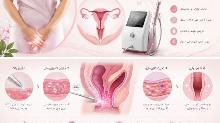 کربوکسی‌ تراپی واژن