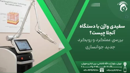 سفیدی واژن با دستگاه آنجلا